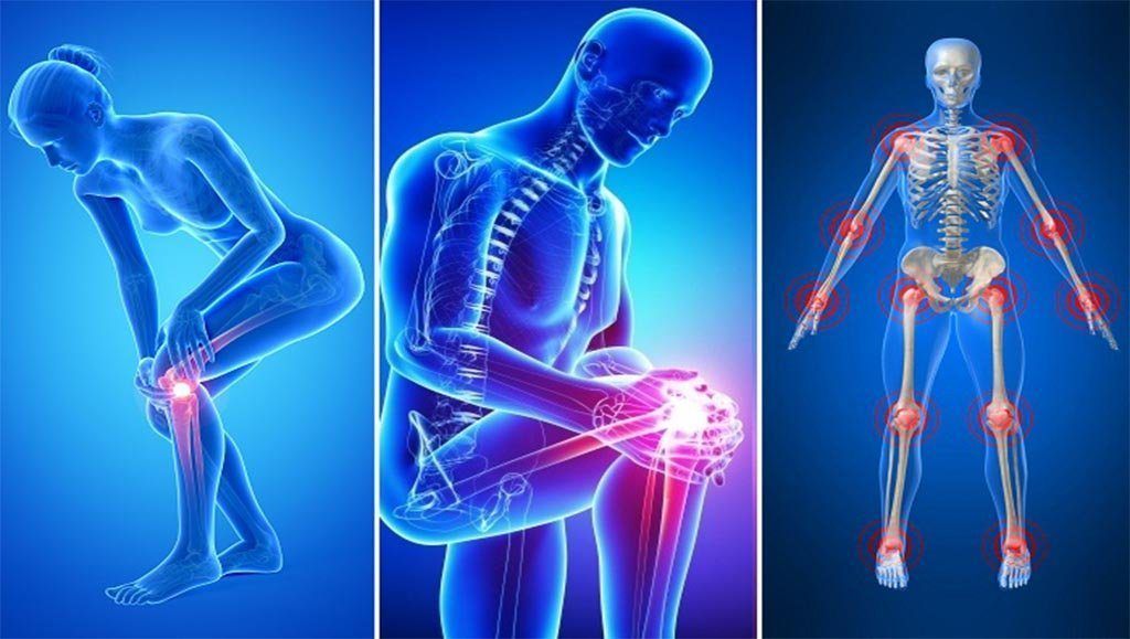 ¿Dolor de articulaciones? ¡Artiforte!