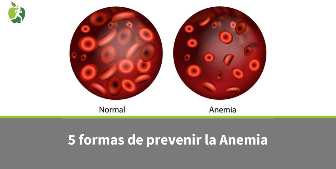 ¿Problemas de anemia? Los 5 mejores suplementos de hierro naturales