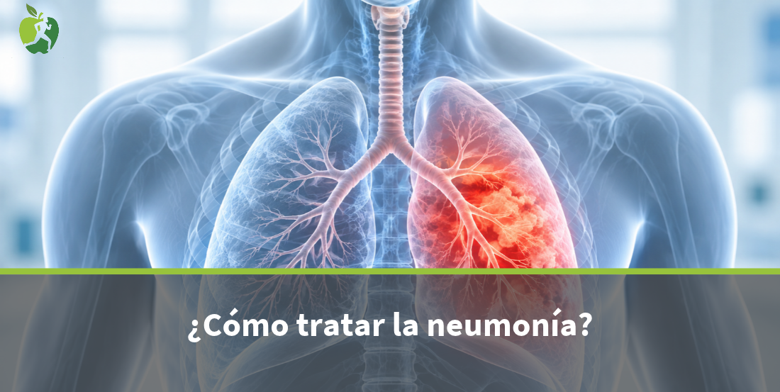 Neumonía: síntomas, tratamiento y diferencia con pulmonía