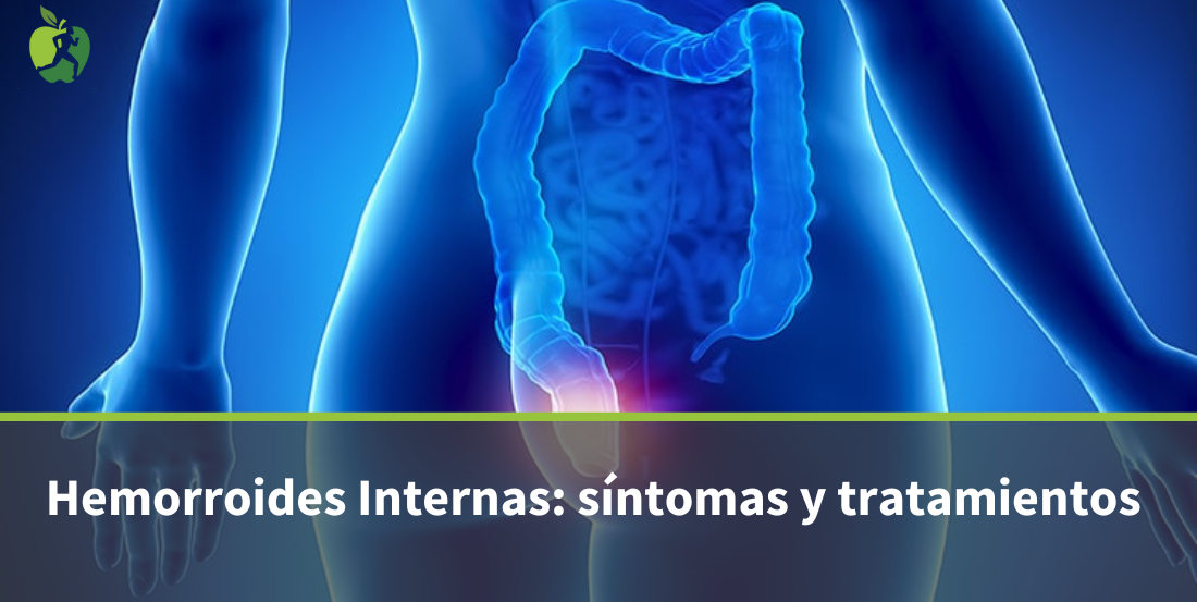 Hemorroides Internas: qué son, causas y síntomas