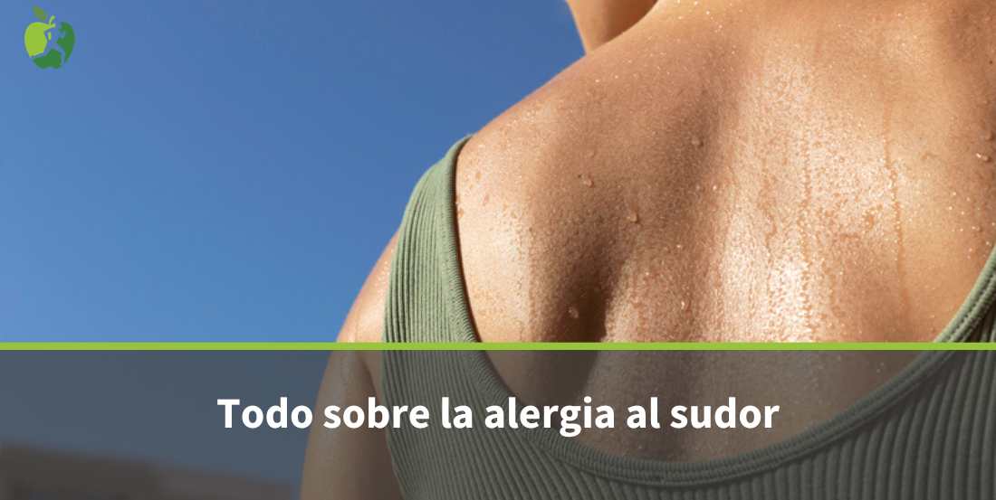 Alergia al sudor: síntomas, causas y cómo tratar la urticaria por sudor